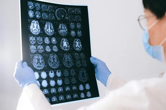 doctor reading brain scan